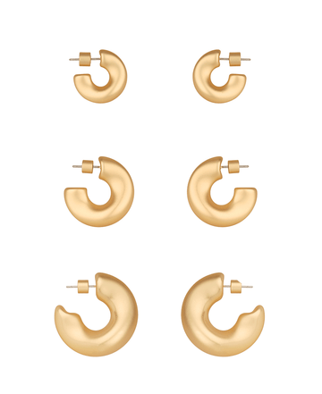 MG